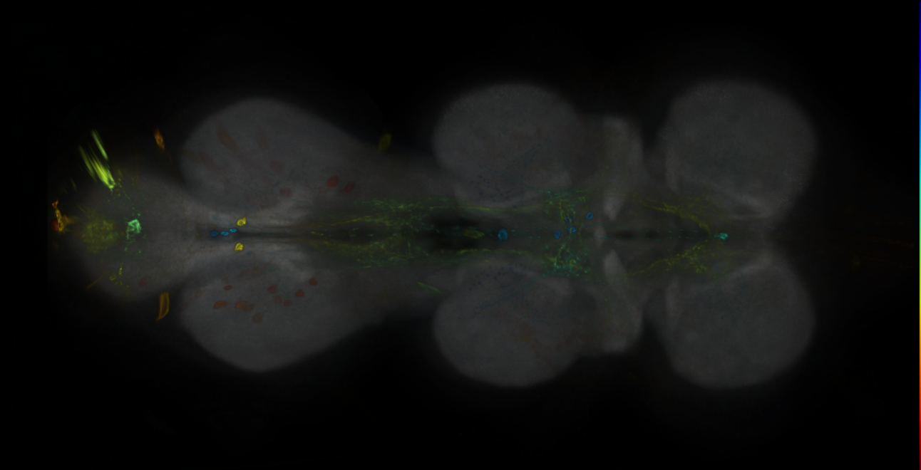 P{GMR34A03-GAL4} expression pattern
