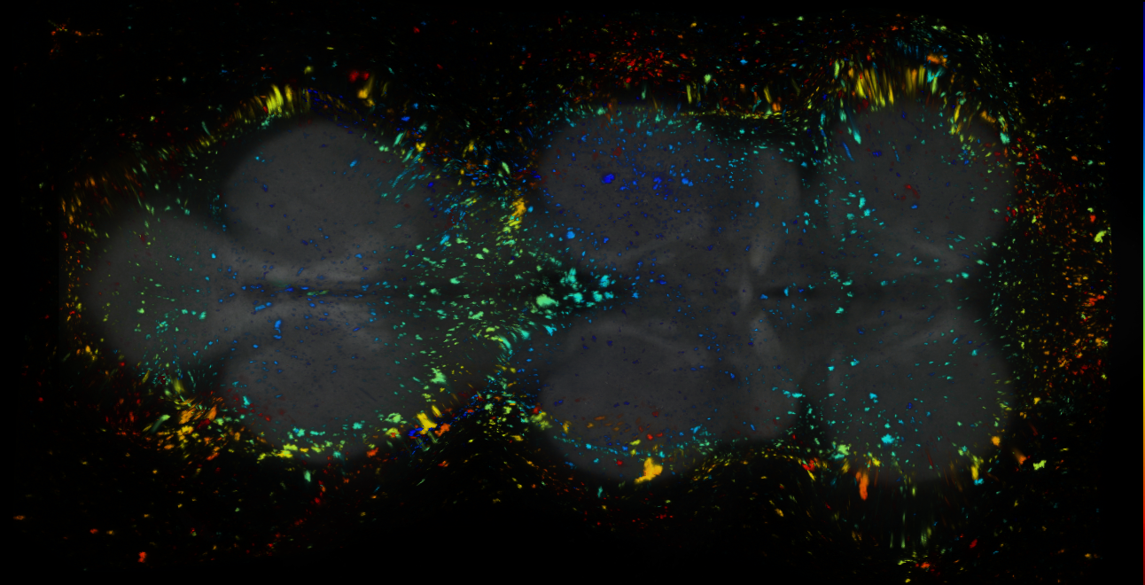 P{GMR34F04-GAL4} expression pattern