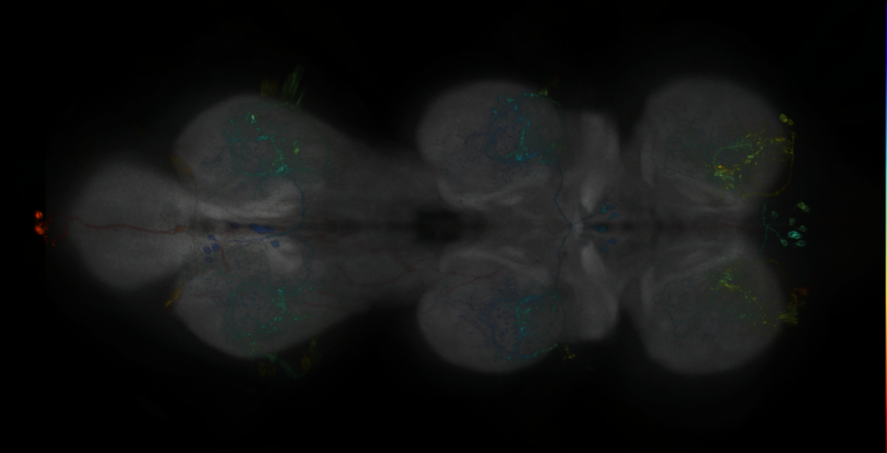 P{GMR34F03-lexA} expression pattern