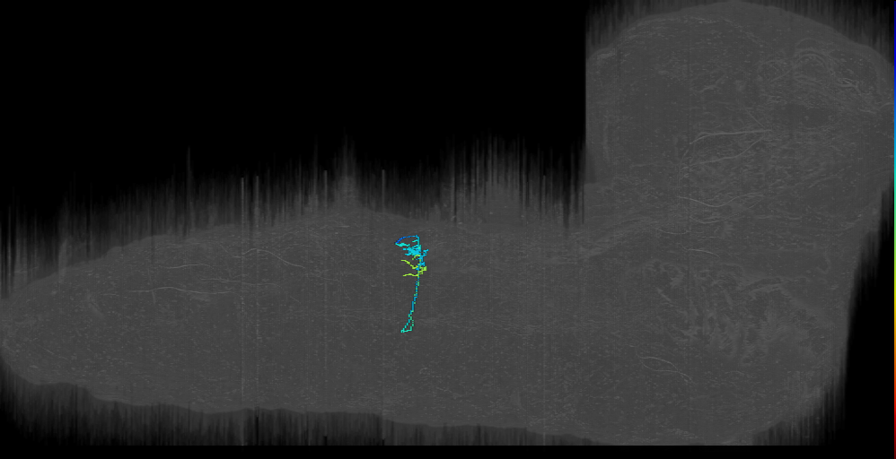 larval DO2 motor neuron of abdominal 2 neuromere