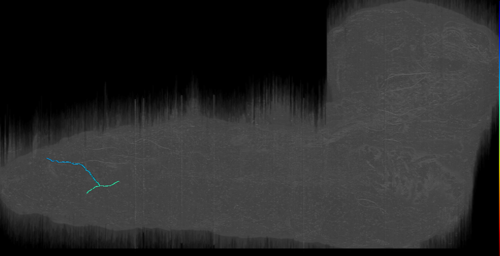 class III or es? (L1EM:1331893)
