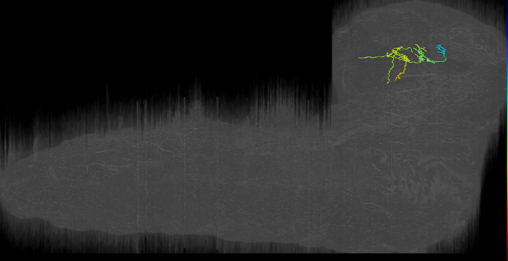 Bilateral near MB_left (L1EM:12299704)