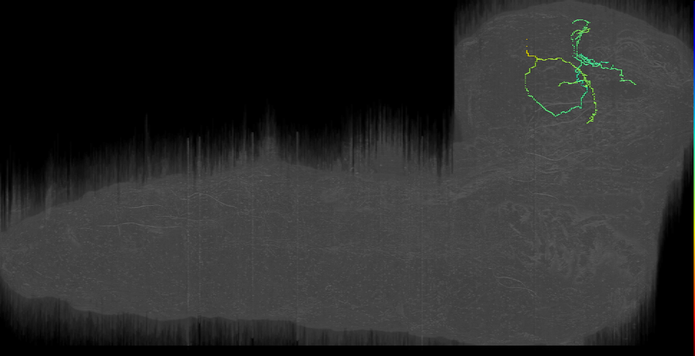 ITP candidate pair 3 left; ITP candidate 3 left (L1EM:16683883)