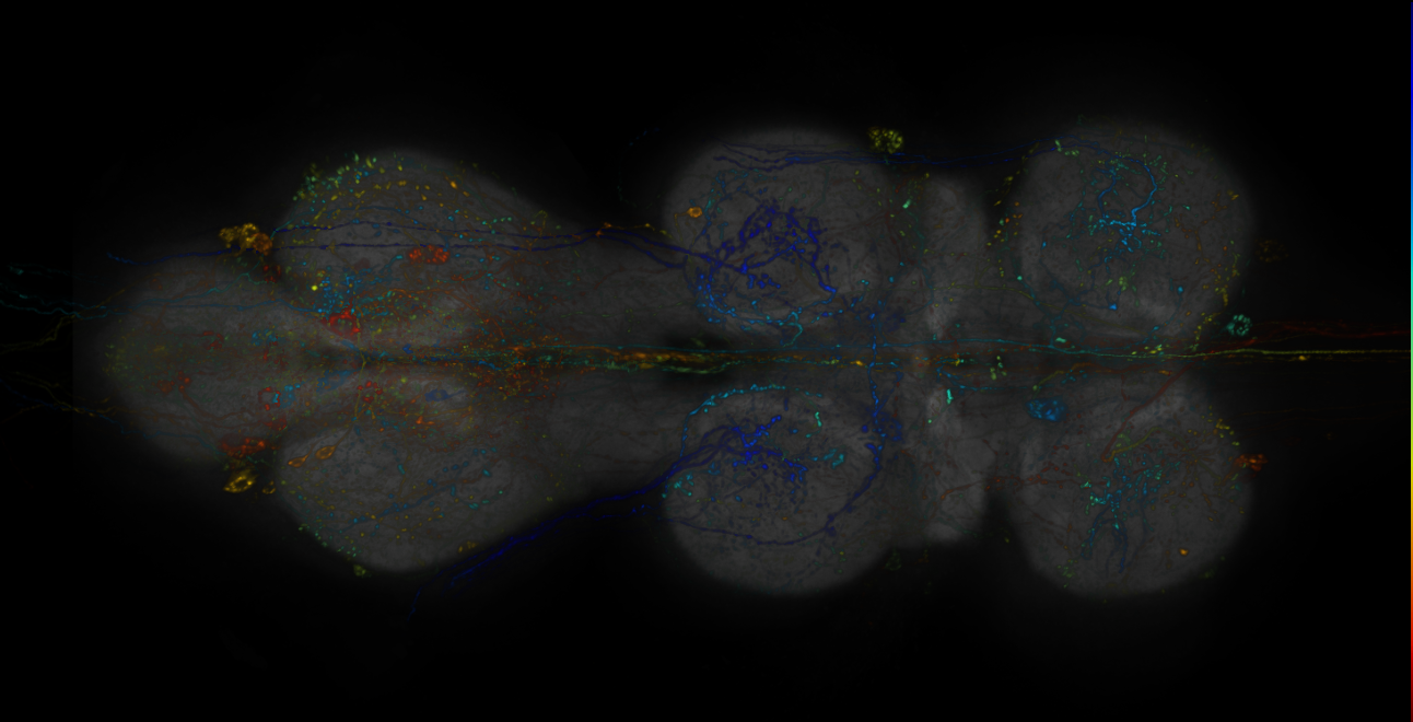 VDRC_VT026396-GAL4_MCFO_VNC_20170901_61_A2_40x