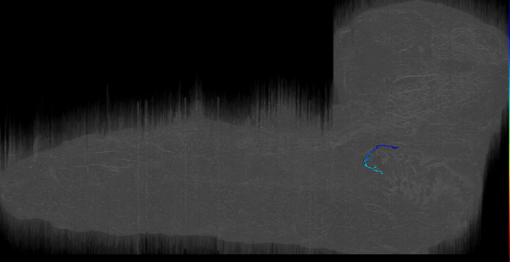 larval prothoracic accessory nerve sensory neuron