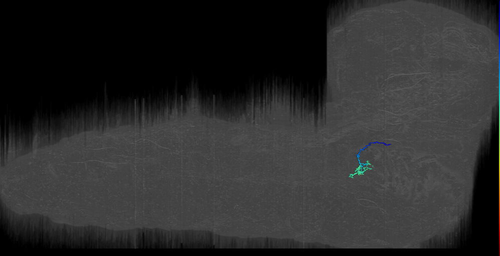 larval prothoracic accessory nerve sensory neuron