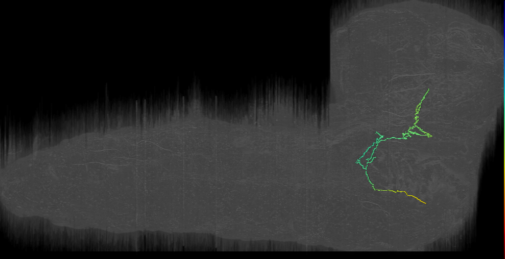 EM L1 Imambocus et al., 2022