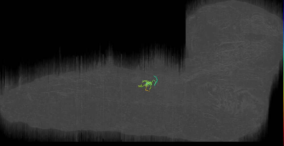 abdominal segment motor neuron