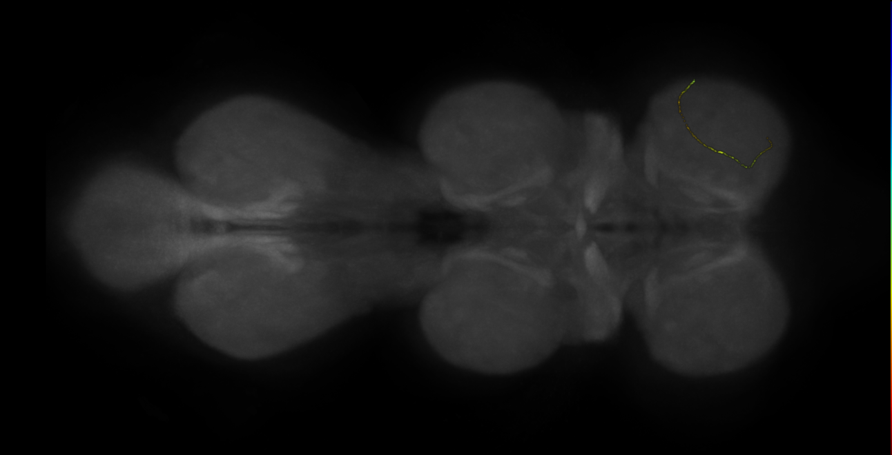 neuron 10986 - radius 500 (FANC:596905)