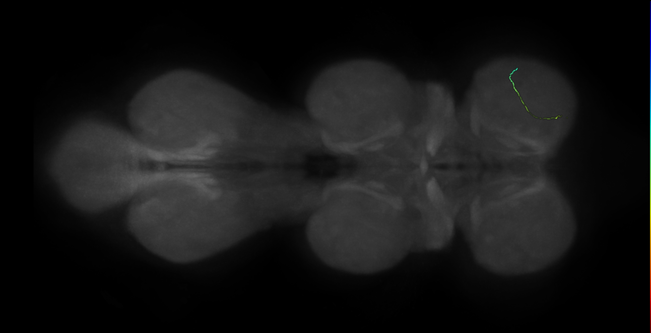 neuron 12767 - radius 500 (FANC:599289)