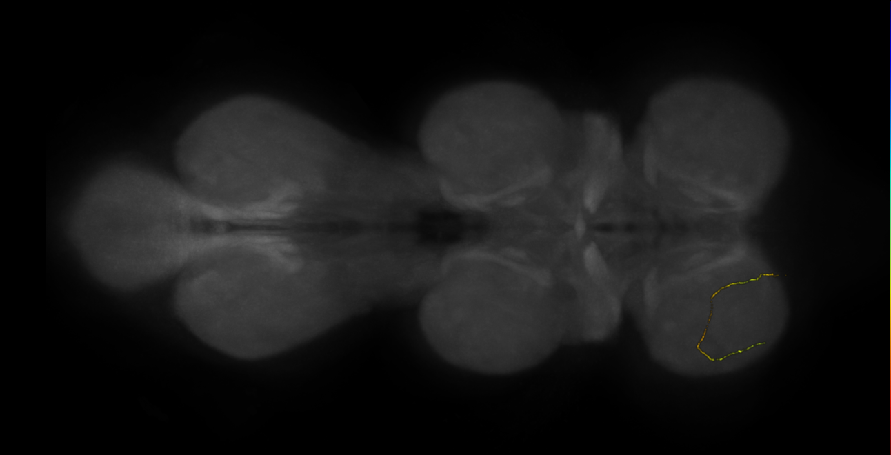 neuron 11320 - flipped - radius 500 (FANC:600697)