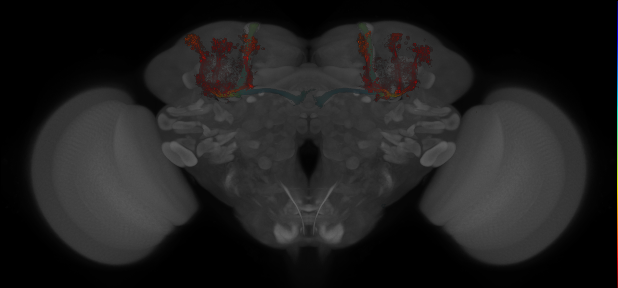 JRC_MB594B_Brain_20130208_31_E4_20x
