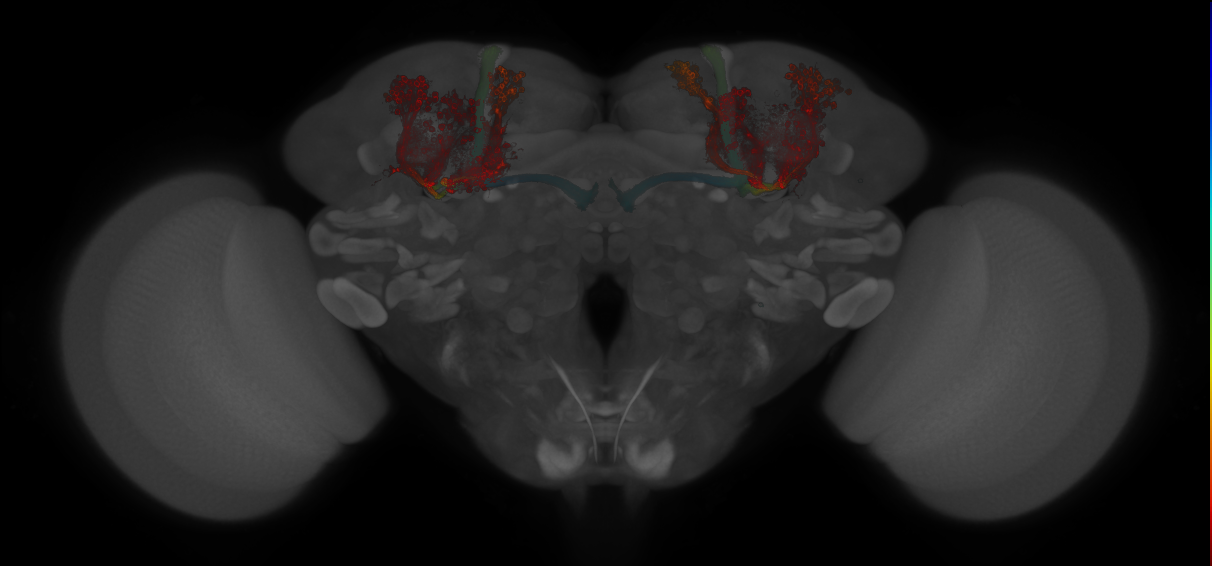JRC_MB594B_Brain_20130208_31_E5_20x