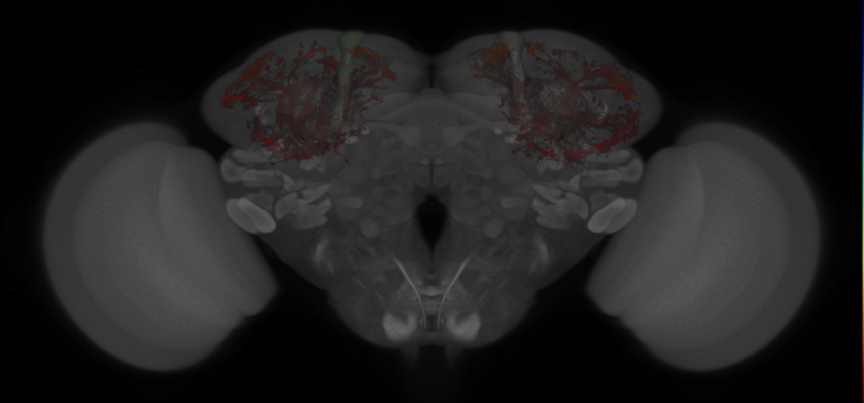 JRC_MB477B_Brain_20121213_33_D5_20x