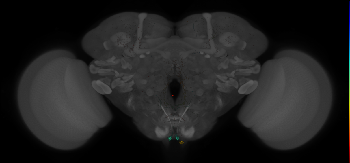 JRC_MB022B_Brain_20121208_31_A3_20x