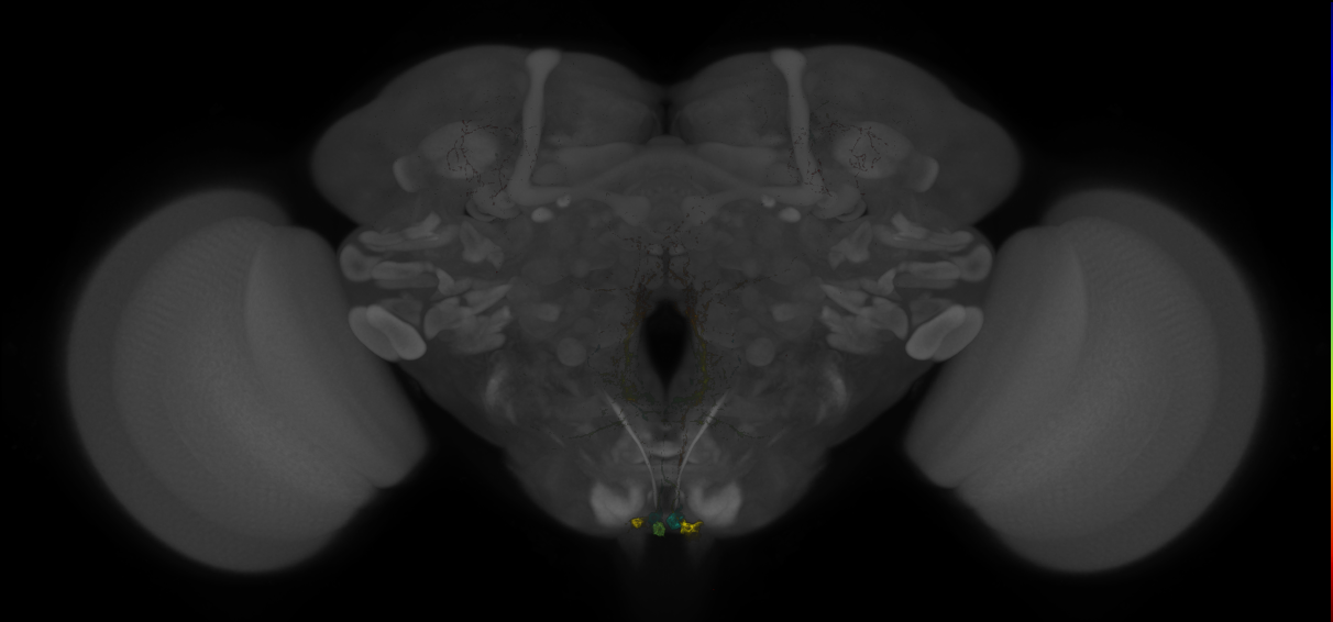 JRC_MB022B_Brain_20121208_31_A5_20x