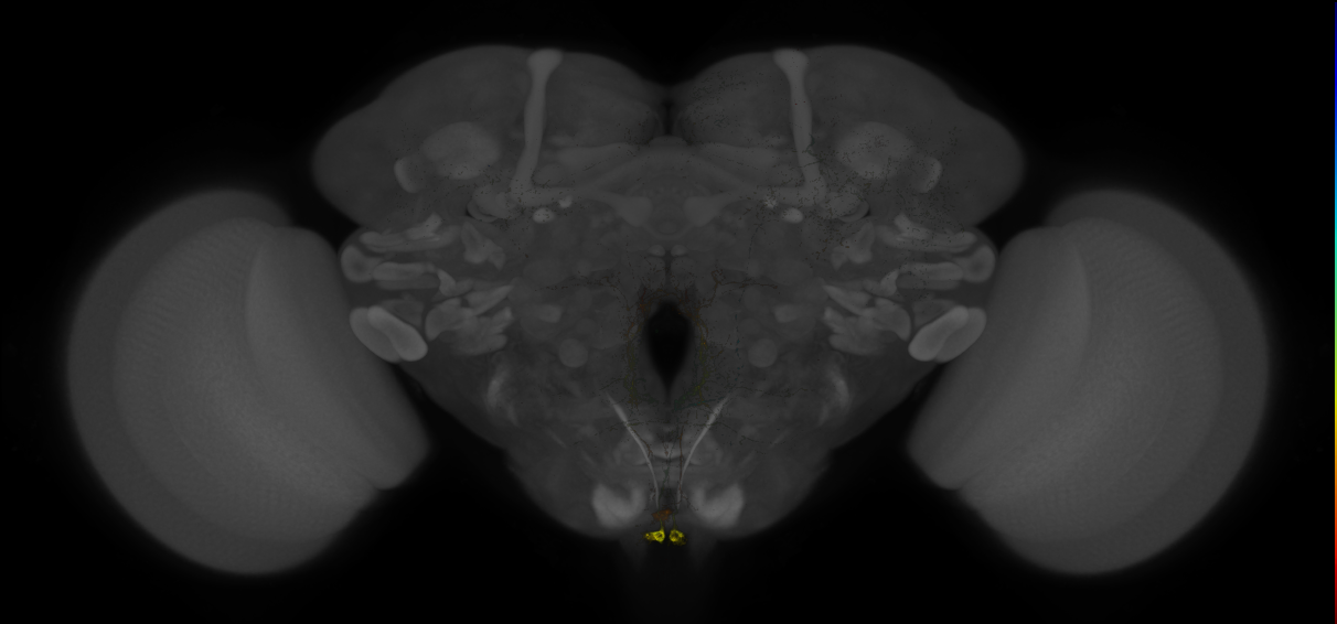 JRC_MB113C_Brain_20121208_31_C2_20x