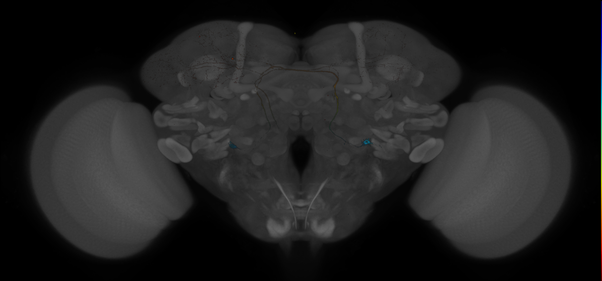 JRC_MB465C_Brain_20121208_31_D5_20x