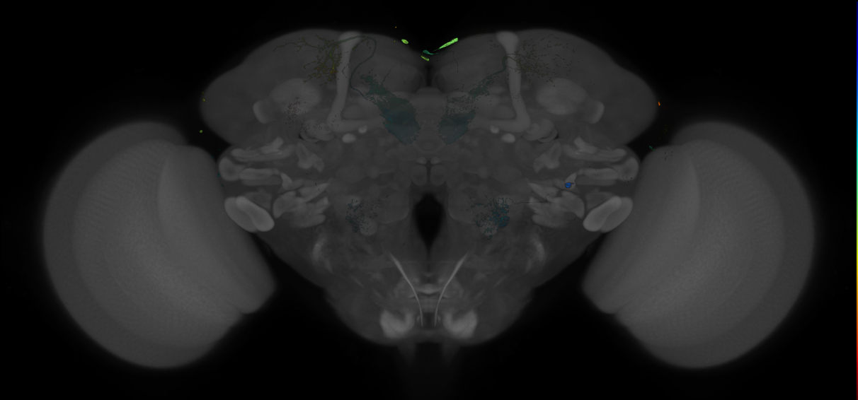 JRC_MB074C_Brain_20121210_31_D2_20x