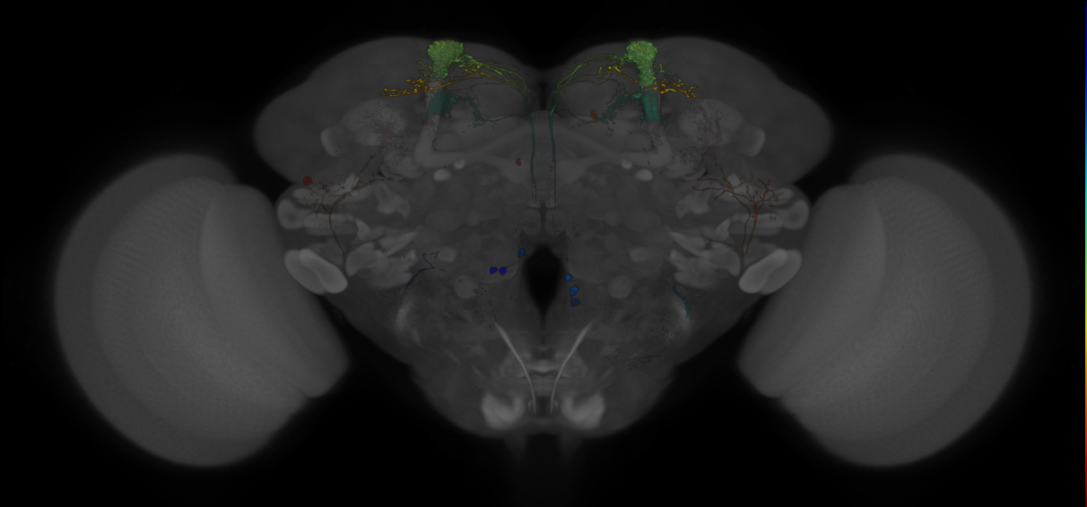 JRC_MB093C_Brain_20121210_31_I3_20x