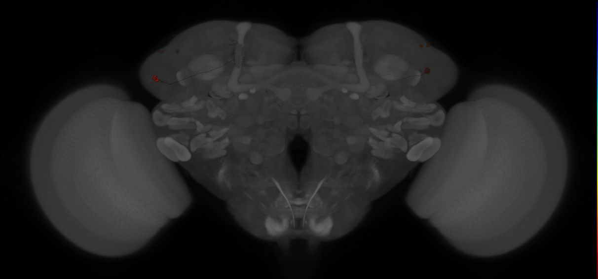 JRC_MB080C_Brain_20121210_32_F2_20x