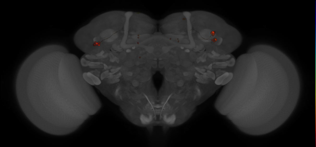 JRC_MB504B_Brain_20121210_33_B1_20x
