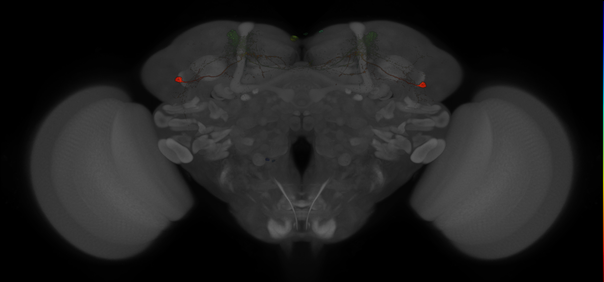 JRC_MB065B_Brain_20121210_33_H3_20x