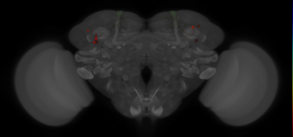 JRC_MB065B_Brain_20121210_33_H5_20x