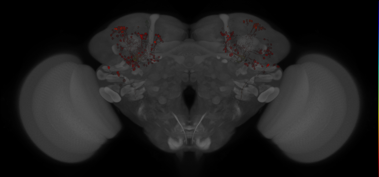 JRC_MB005B_Brain_20121213_32_A3_20x