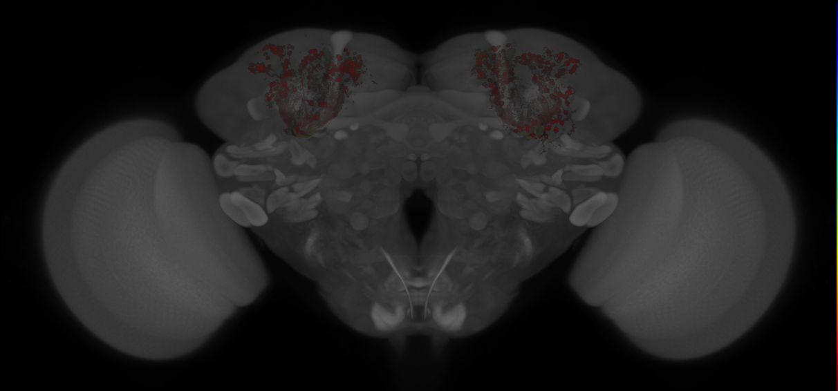 JRC_MB370B_Brain_20121213_32_B3_20x