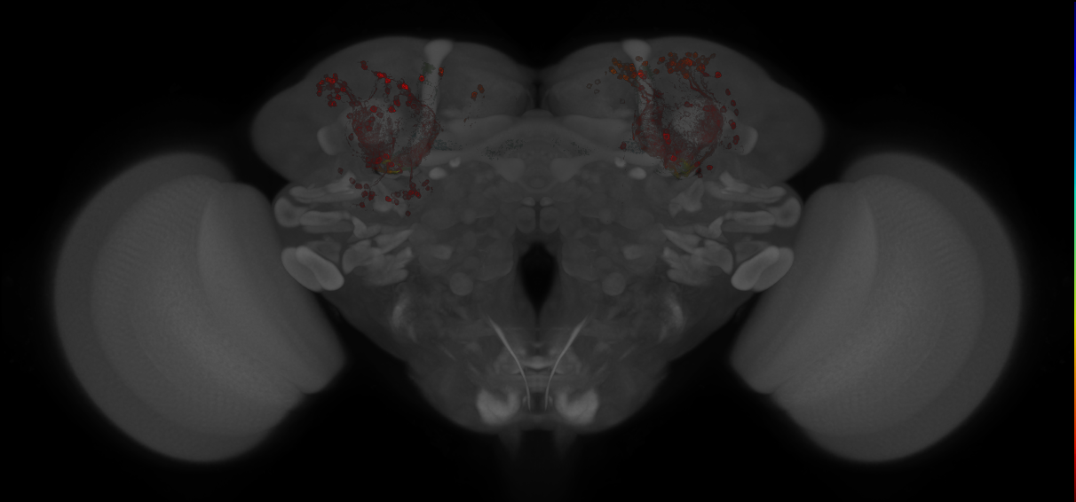 JRC_MB418B_Brain_20121213_32_D5_20x