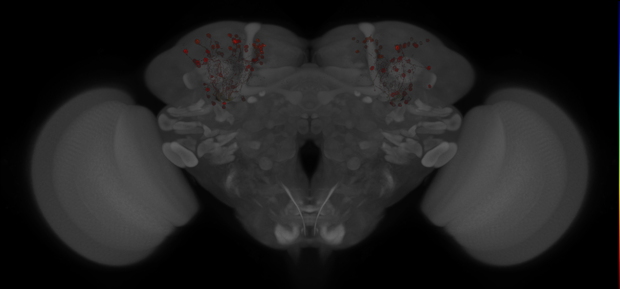 JRC_MB463B_Brain_20121213_32_E1_20x