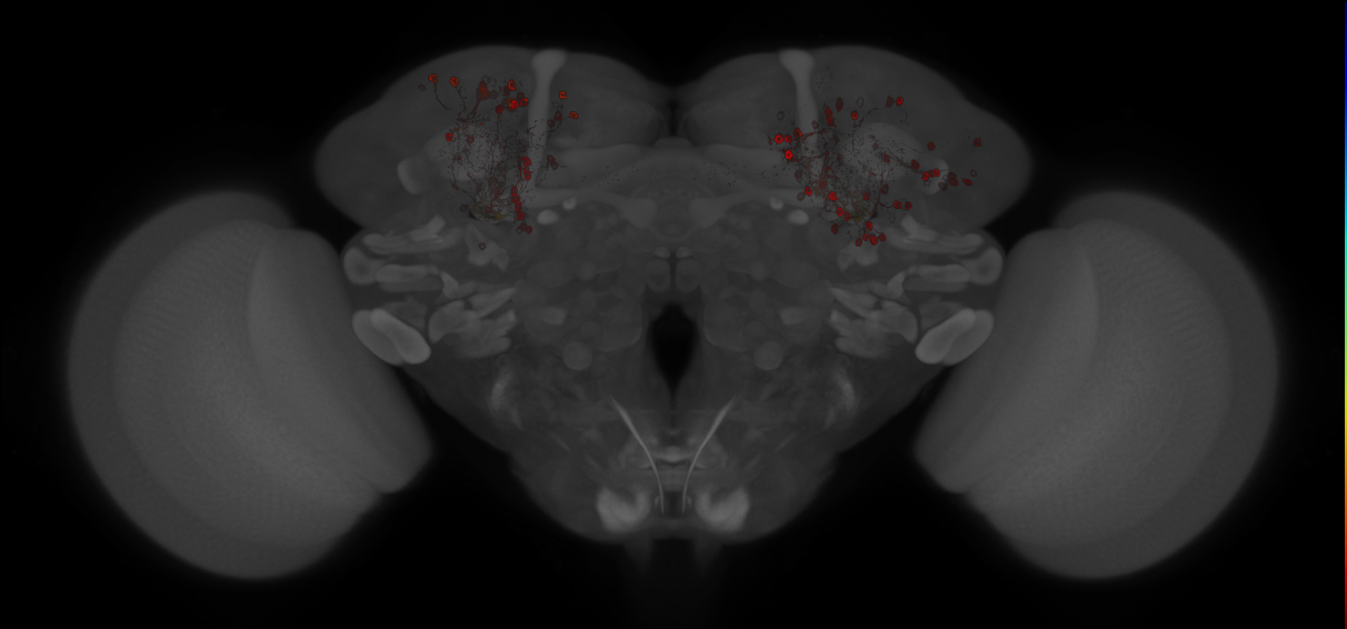 JRC_MB463B_Brain_20121213_32_E2_20x