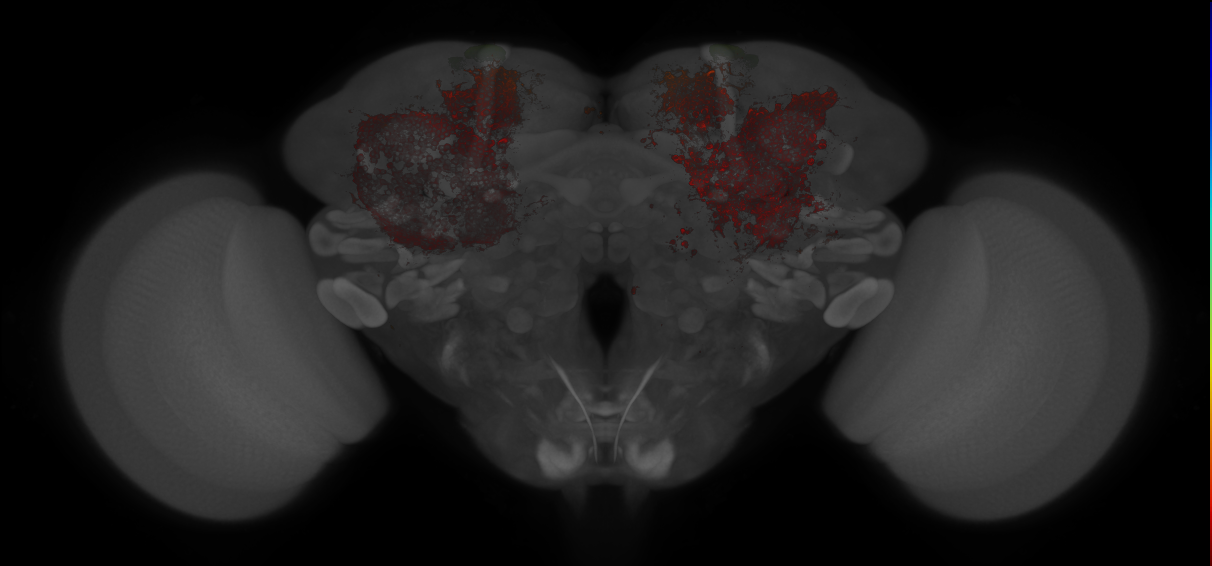 JRC_MB010B_Brain_20121213_31_A2_20x