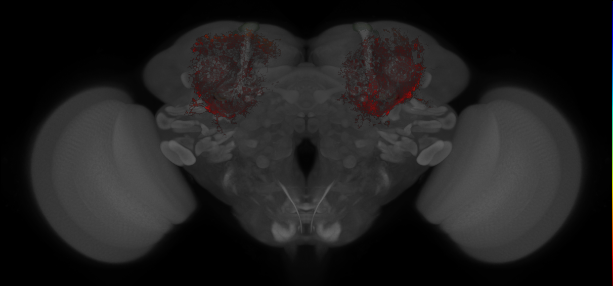 JRC_MB417B_Brain_20121213_31_C1_20x