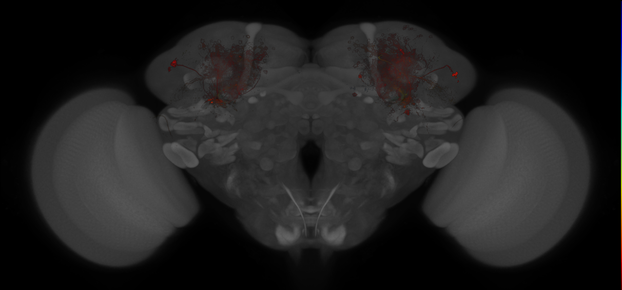 JRC_MB009B_Brain_20121213_31_E3_20x