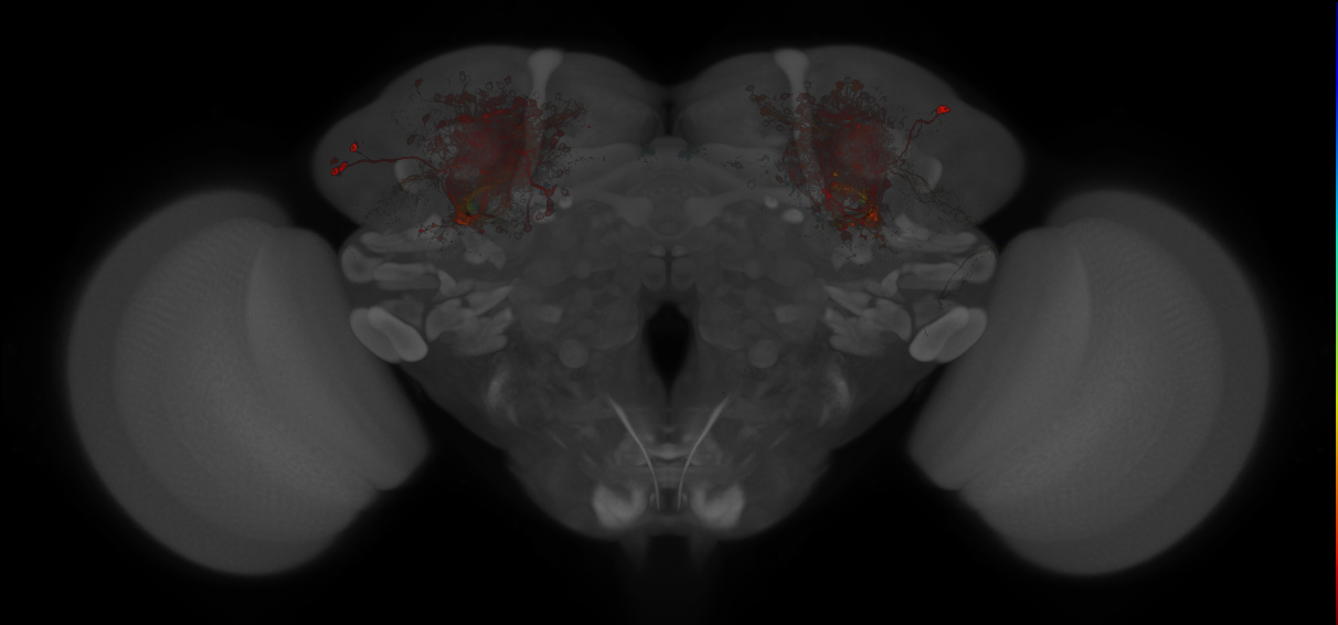 JRC_MB009B_Brain_20121213_31_E5_20x