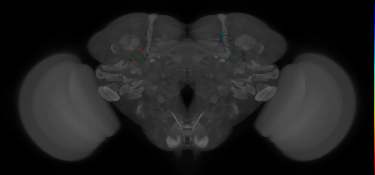 JRC_MB112C_Brain_20121208_32_D4_20x