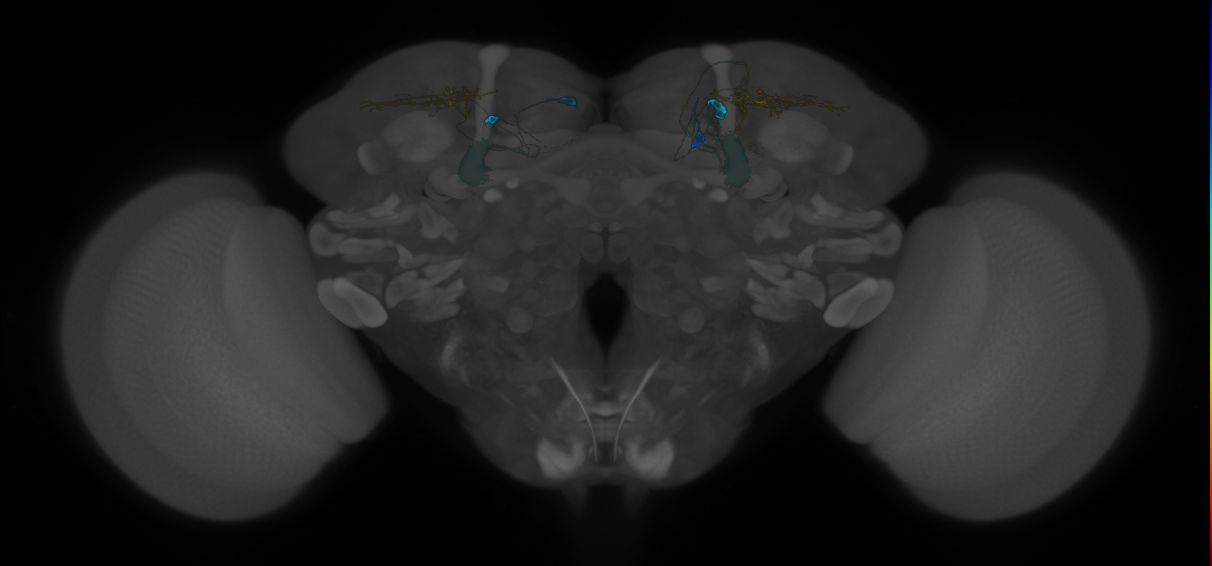 JRC_MB310C_Brain_20121217_31_F1_20x