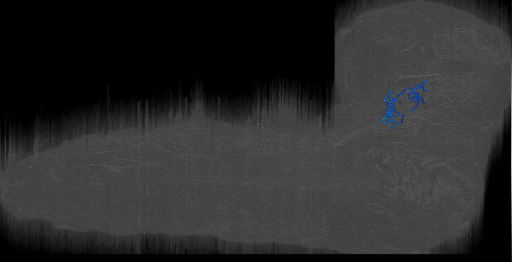 mechanosensory projection neuron