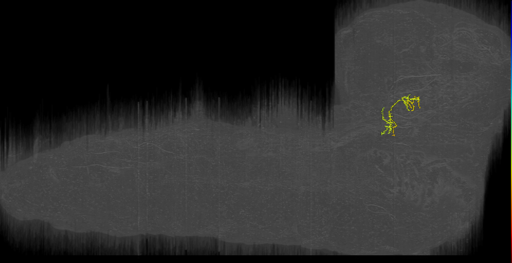 proprioceptive projection neuron