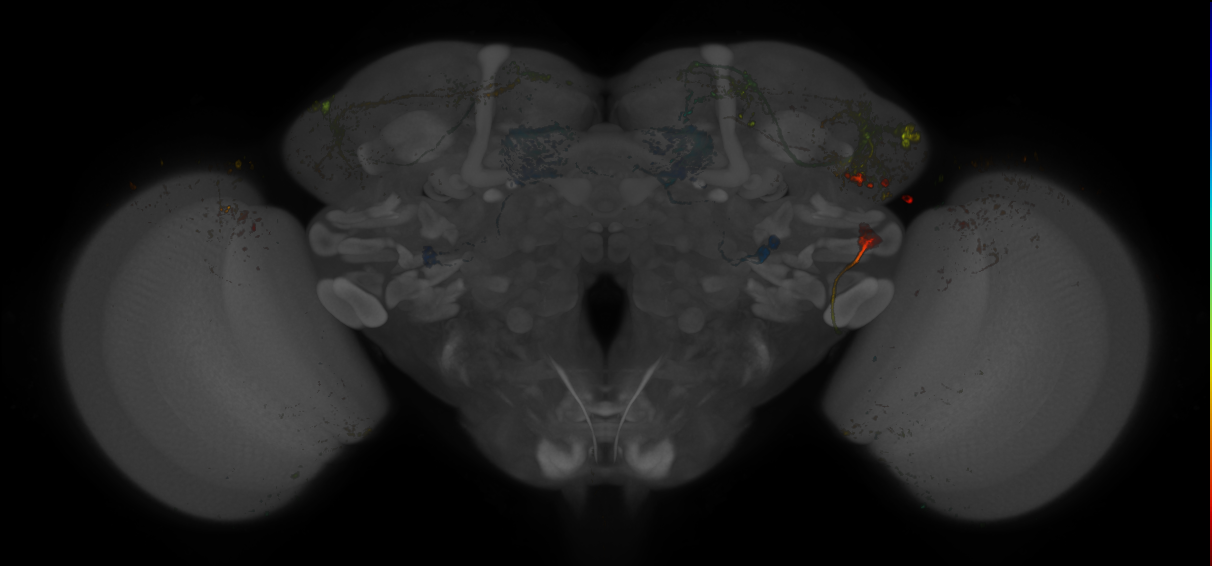 JRC_MB083C_Brain_20170531_31_H4_20x