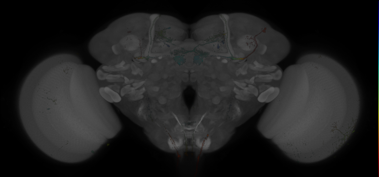 JRC_MB301B_Brain_20170829_33_C1_20x