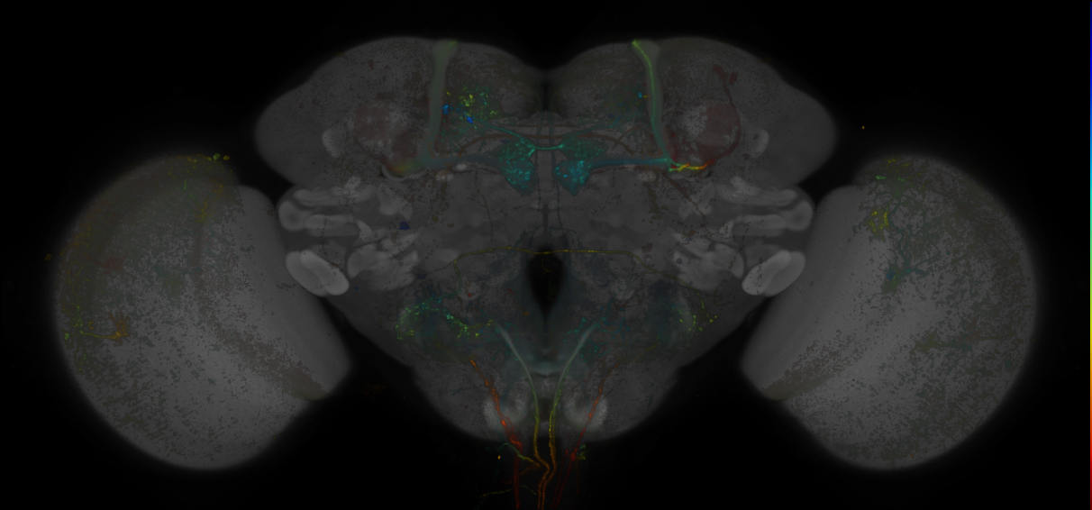 JRC_MB301B_Brain_20170829_33_C6_20x
