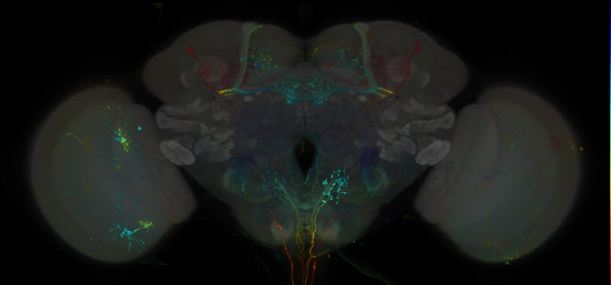 JRC_MB301B_Brain_20170829_33_D5_20x