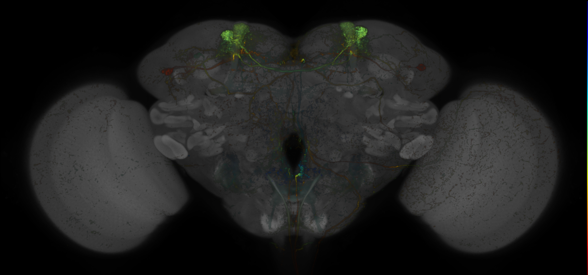 JRC_MB308B_Brain_20170829_33_E5_20x