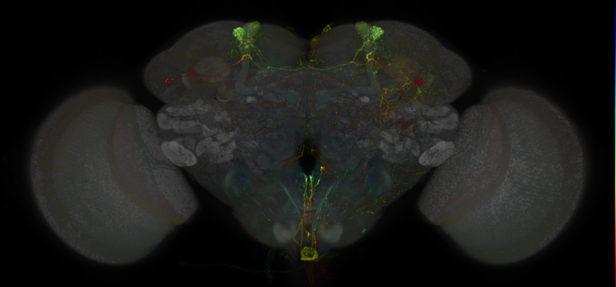JRC_MB308B_Brain_20170829_33_E6_20x