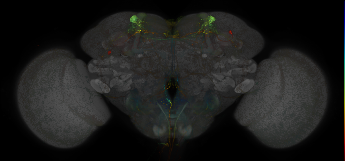 JRC_MB308B_Brain_20170829_33_F5_20x