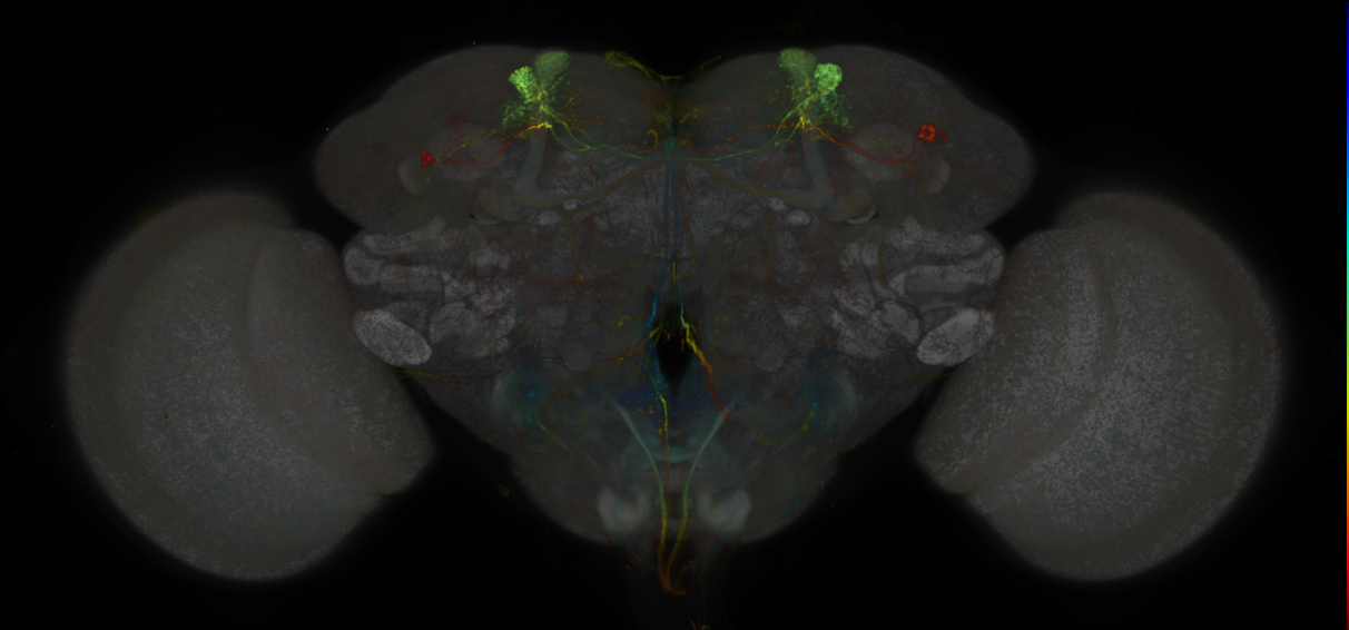 JRC_MB308B_Brain_20170829_33_F6_20x