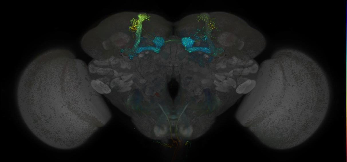 JRC_MB434B_Brain_20170829_33_H3_20x